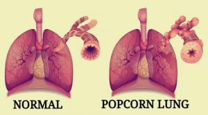 Pop-Corn Lung